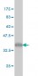 UHRF1 Antibody (monoclonal) (M01)